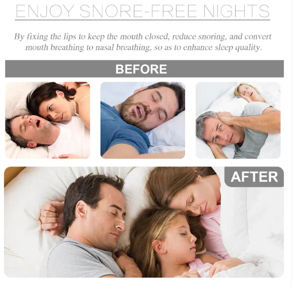 Anti-Snoring Nose Strips